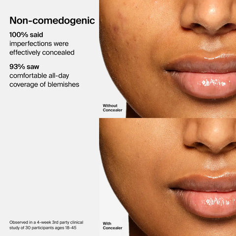 Triclone™ Skin Tech Concealer
