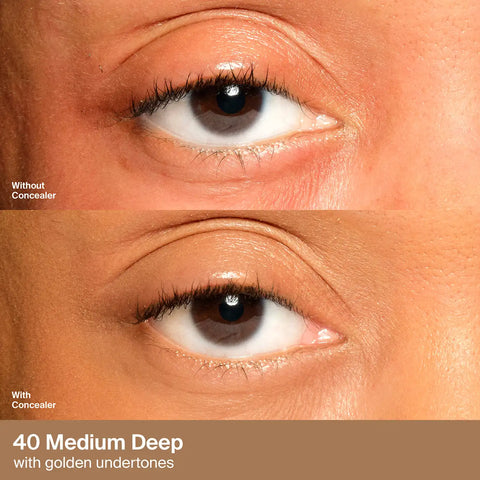 Triclone™ Skin Tech Concealer