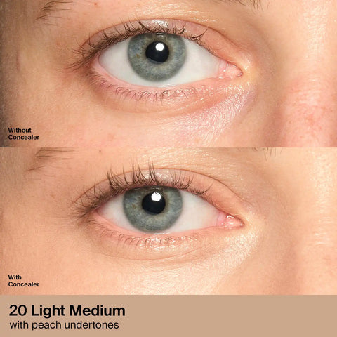 Triclone™ Skin Tech Concealer