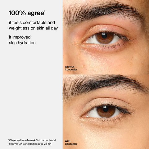 Triclone™ Skin Tech Concealer